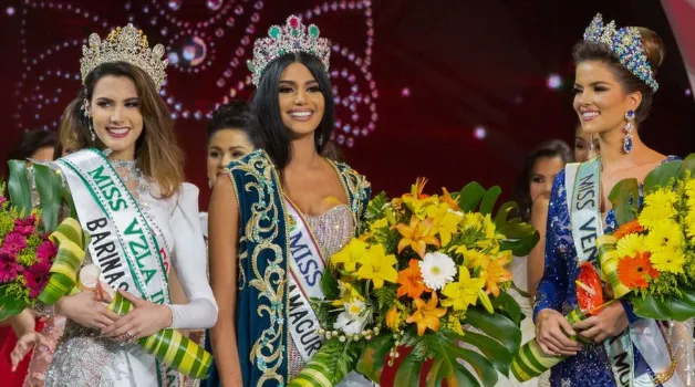 Venezuela Beauty Queens and Plastic Surgery: The Dark Side of Pageant Culture