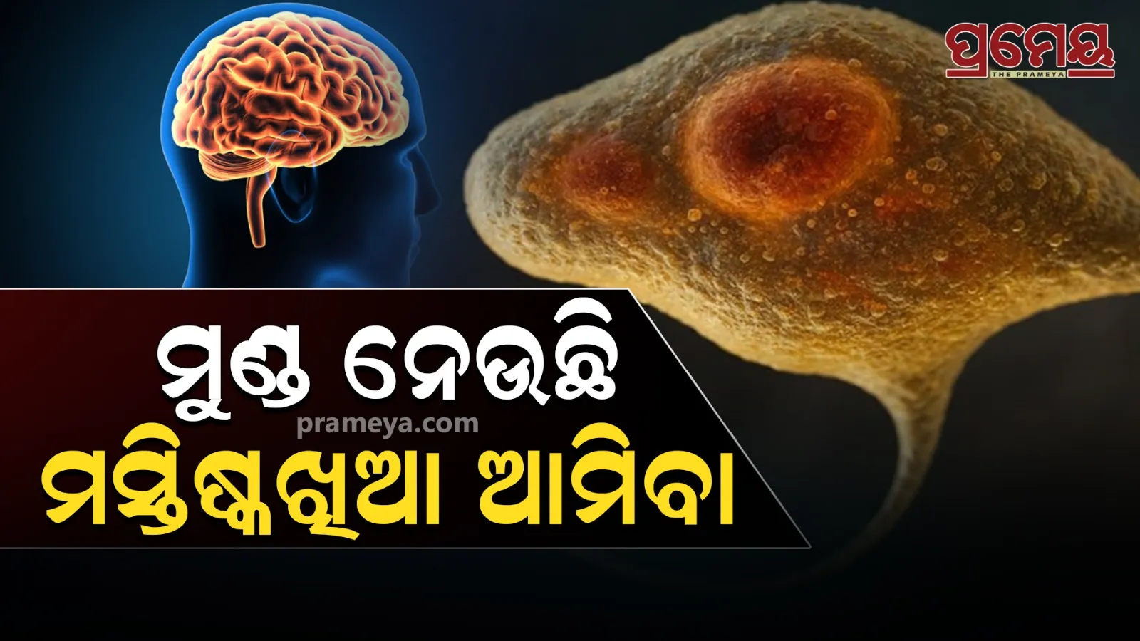 'Brain-Eating Amoeba' 