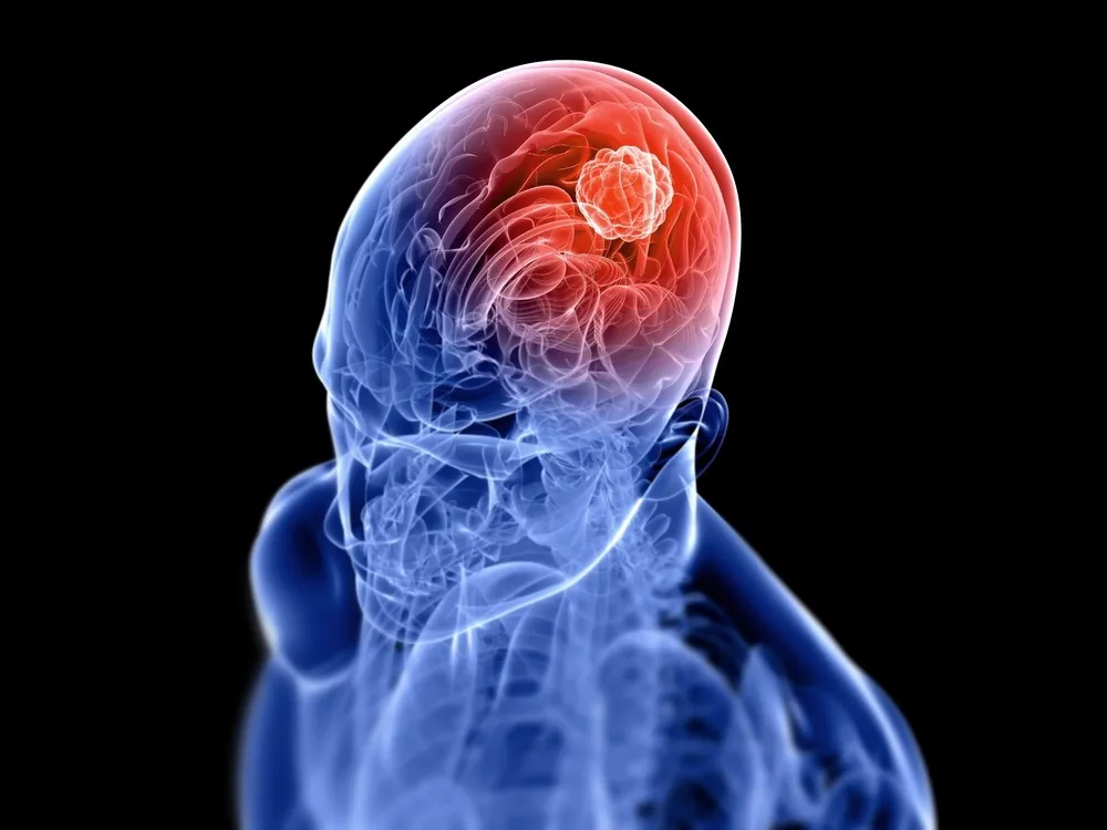 brain