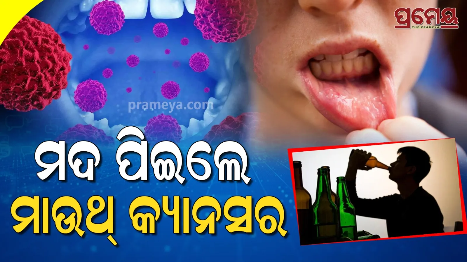 oral cancer
