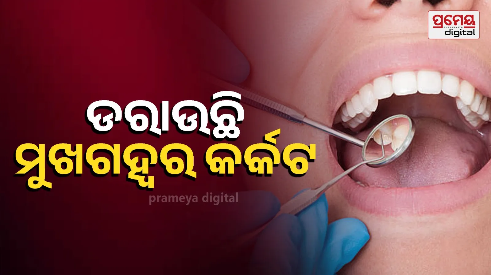 Oral Cancer