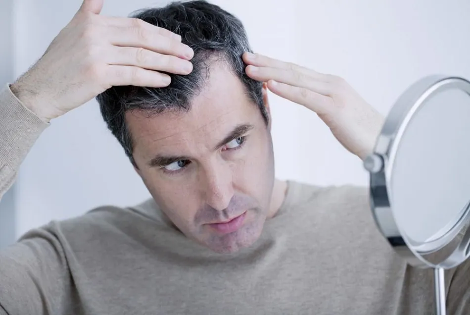 hair loss